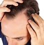 Health and beauty information hair loss